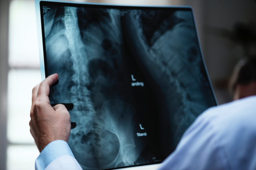 chronic back pain doctor of chiropractic assessing x-ray